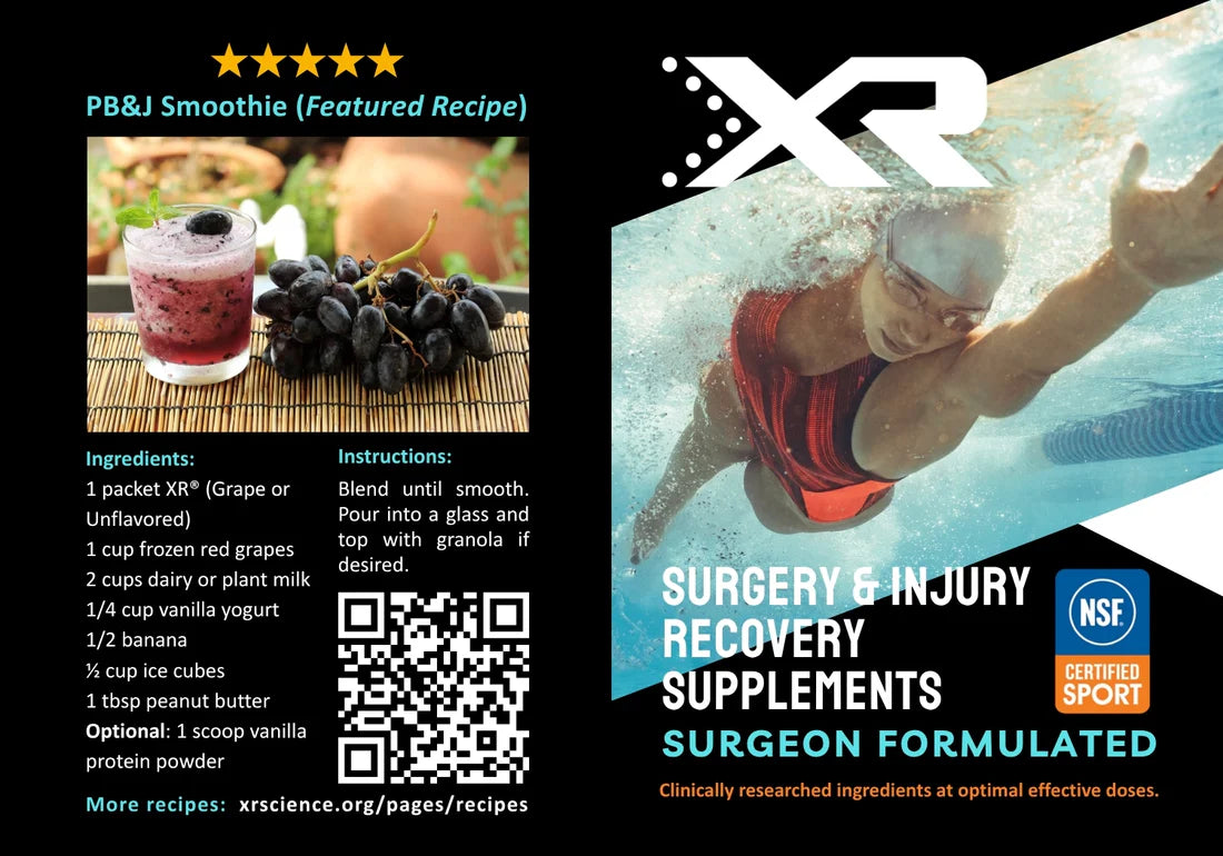 XR® Surgical Recovery Program | 3 Weeks